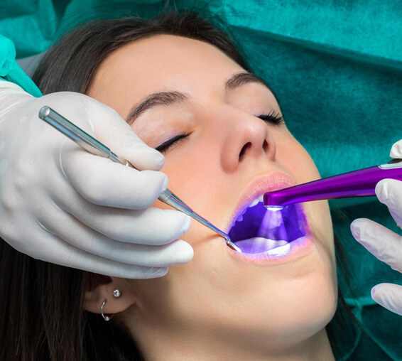 Patient receiving dental treatment with blue UV light curing tool at dental office