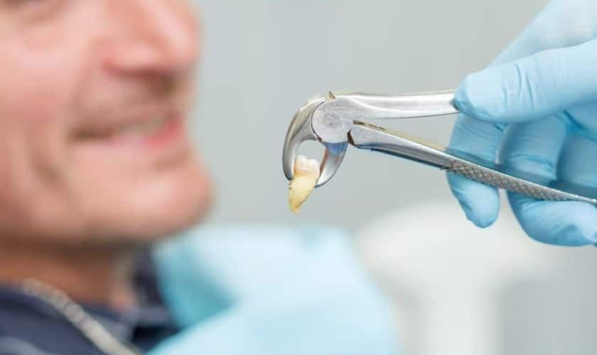When Tooth Extraction is Necessary: Understanding the Procedure