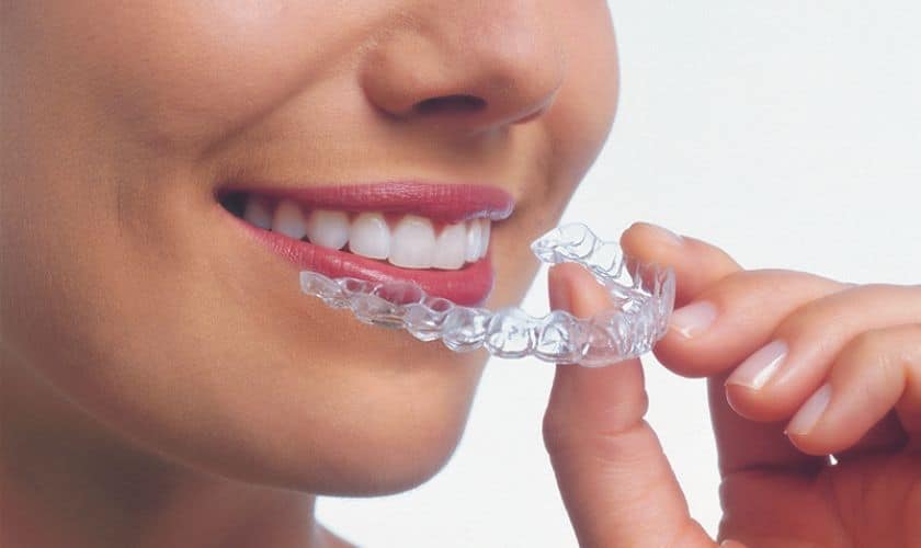 A New Smile Emerges: What to Expect After Completing Invisalign Treatment - Hurd Family Dental