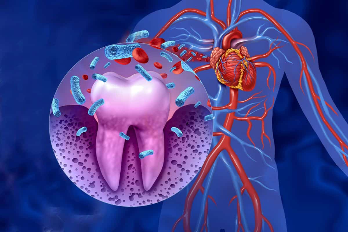 Gum Disease May Be the Cause of Heart Disease - Dentist in Lee's Summit - Hurd Family Dental