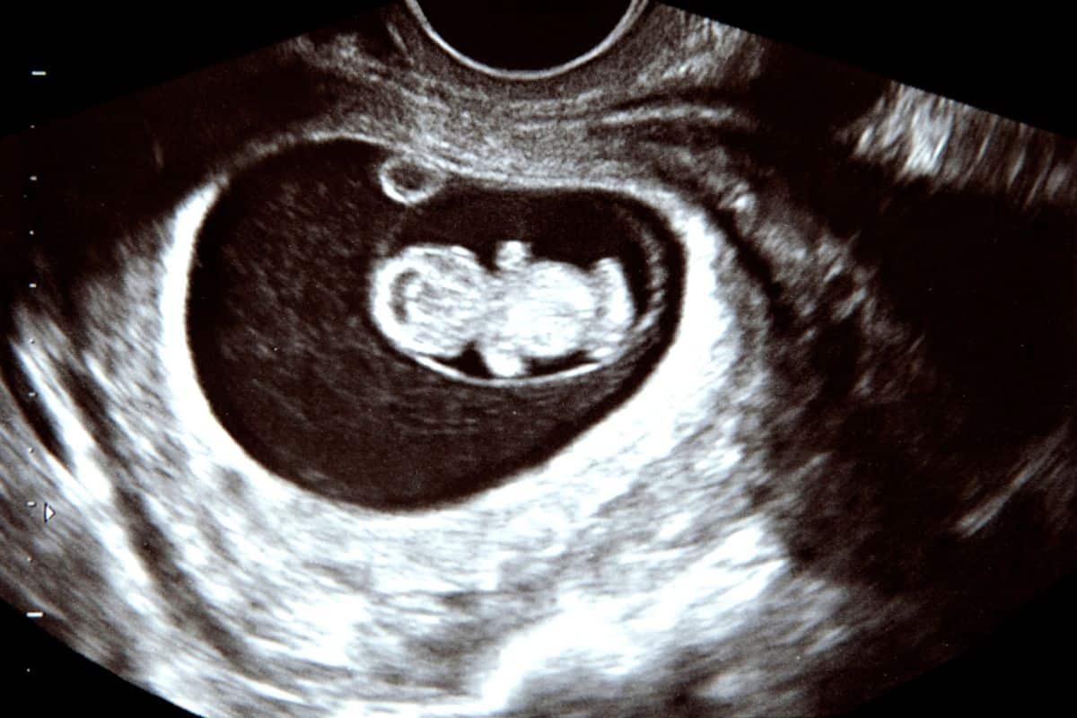 Teeth Whitening During Pregnancy is right Recommendation by ADA - Hurd Family Dental