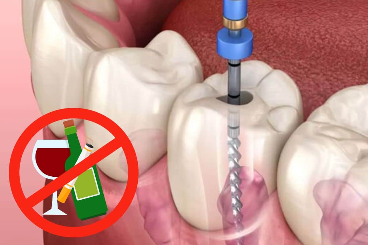 Drinking Alcohol & Smoking After Root Canal in Lee s Summit MO at Hurd Family Dental