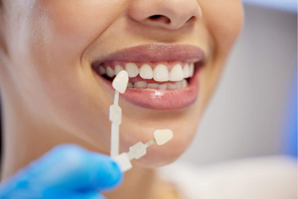 Dental Veneers Treatment on Crooked Teeth in Lee's Summit MO - Hurd Family Dental