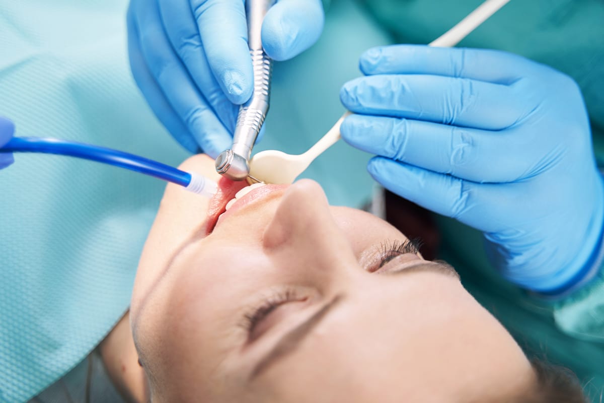 Root Canal Therapy Lees Summit