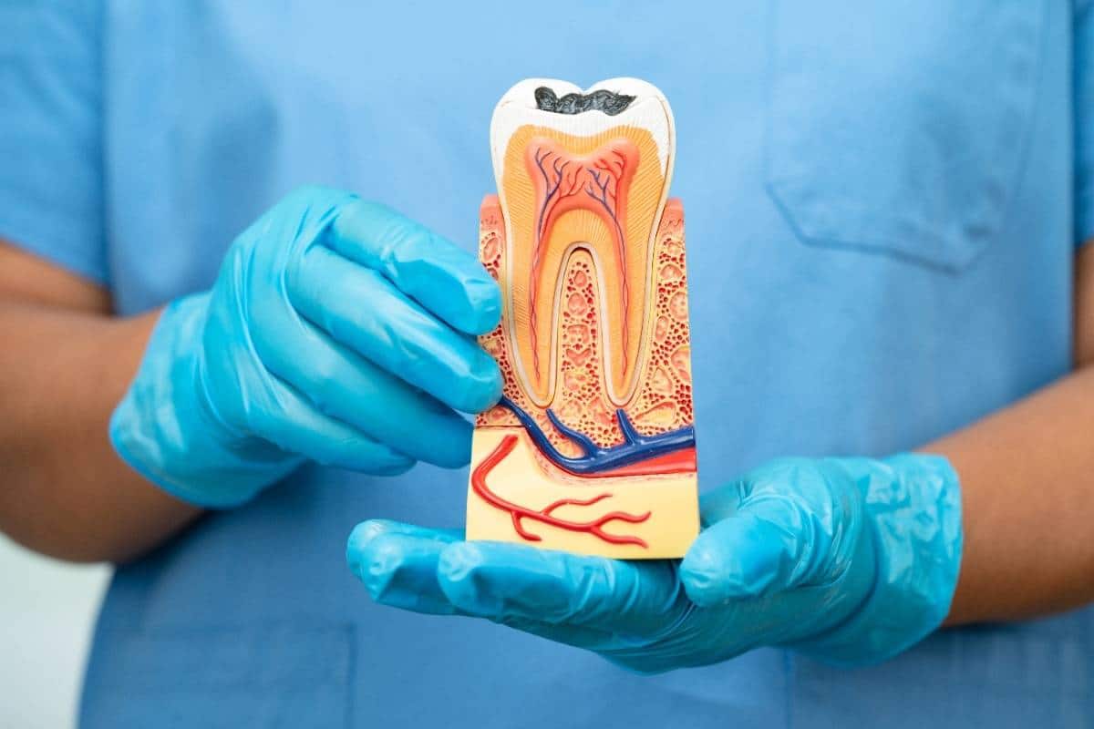 Root Canal Therapy Lee's Summit